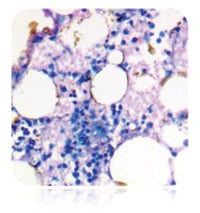 Azer Scientific May-Grunwald Giemsa Stain Kit