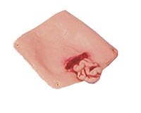 Nasco Healthcare Abdominal Wound Training Manikin (Each)