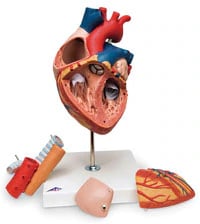 Nasco Healthcare Giant Heart Anatomical Model with Esophagus and Trachea, Removable, 12-5/8 x 7 x 7 inches