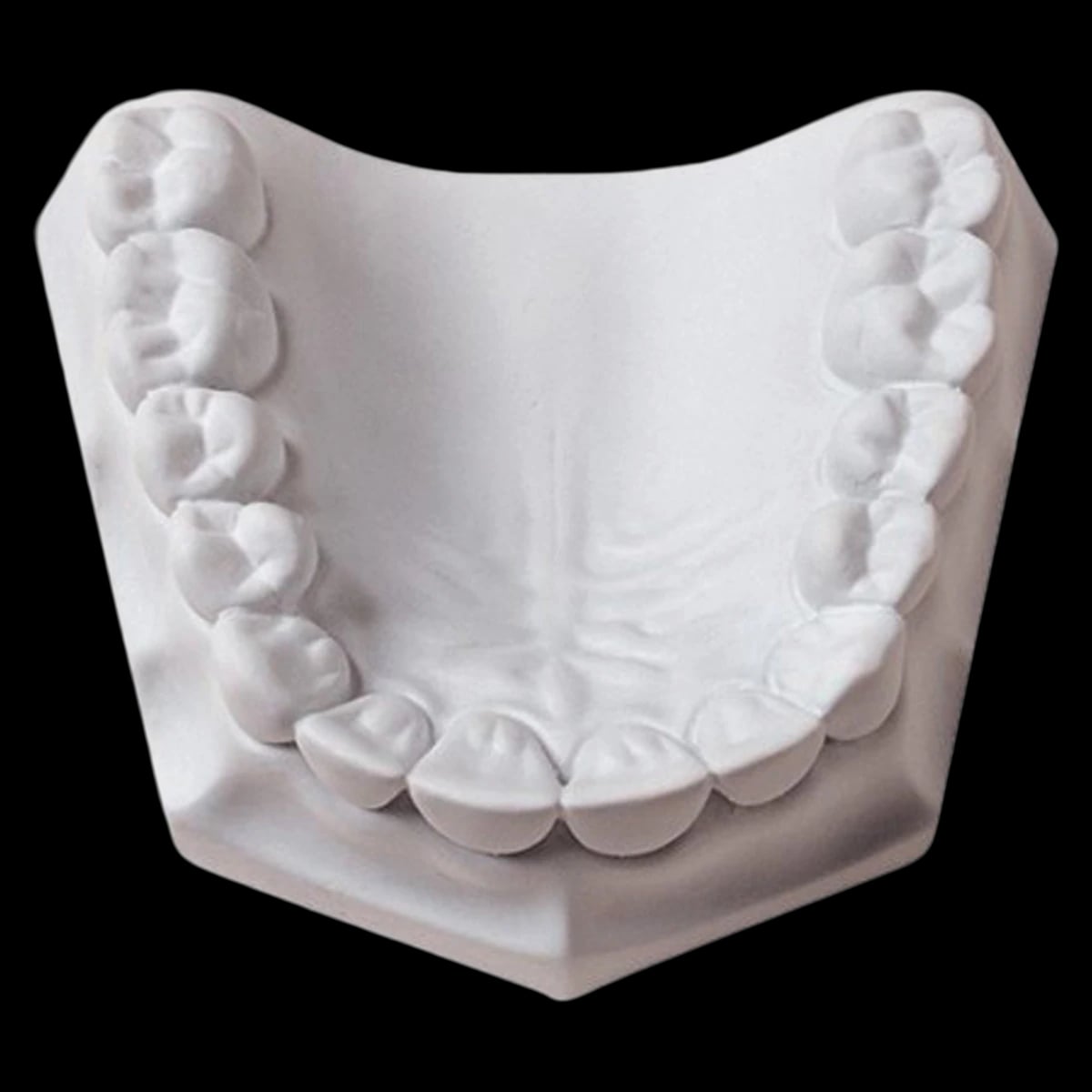 Whip Mix Microstone White Dental Stone, ISO Type 3, 33 lb (15 kg) Carton, #330055