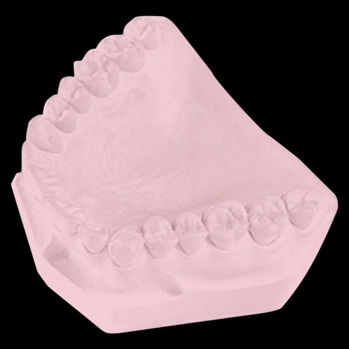 Garreco Express Set Pink Type IV Specialty Stone, 25 Lbs, 1285025