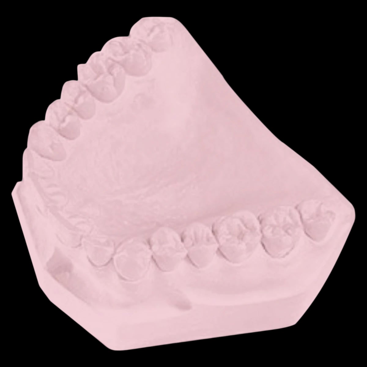 Garreco Express Set Pink Type IV Dental Stone, 47.5 lb Box, 1285050