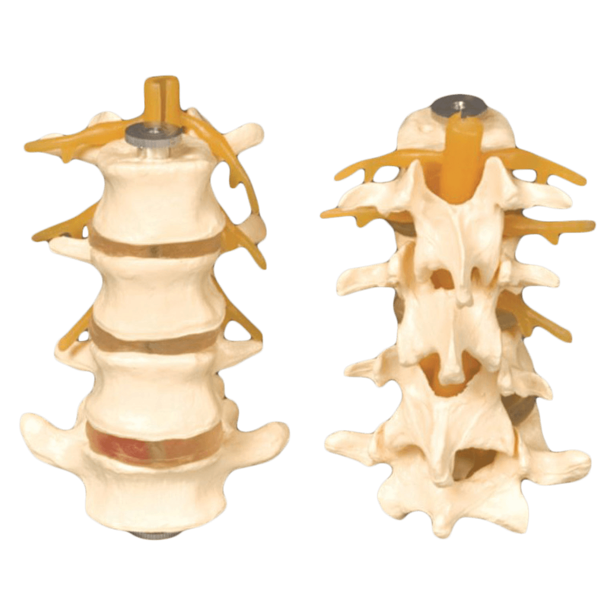 Four-Part Lumbar Set Anatomical Model, Adult Vertebrae/Discs/Spinal Cord/Nerve Roots, 6x3", Each