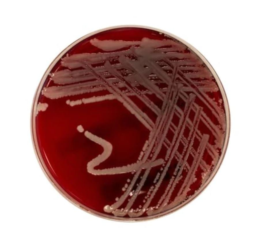 Blood Agar TSA w/5% Trypticase Soy Agar Spacesaver Plate, 10/Package