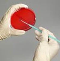 Remel Throat Culture Quality Control Kit, 2/Package
