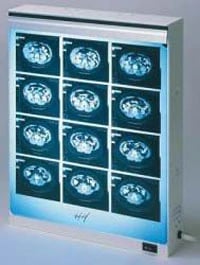 Wolf X-Ray Econoline 3-Bank X-Ray Illuminator