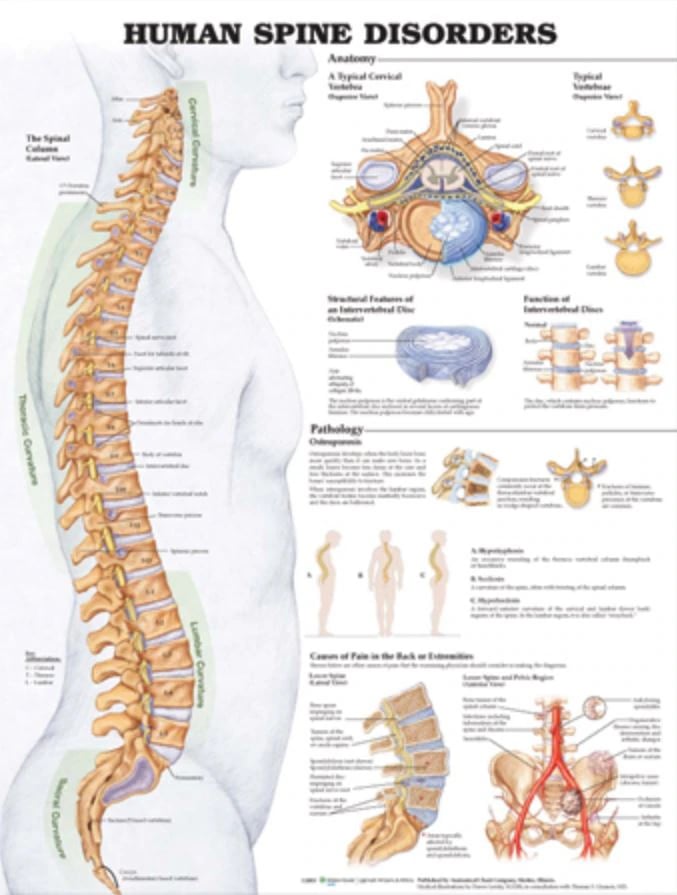 Human Spine Disorders Anatomical Chart, 20" x 26", Flexible, Each
