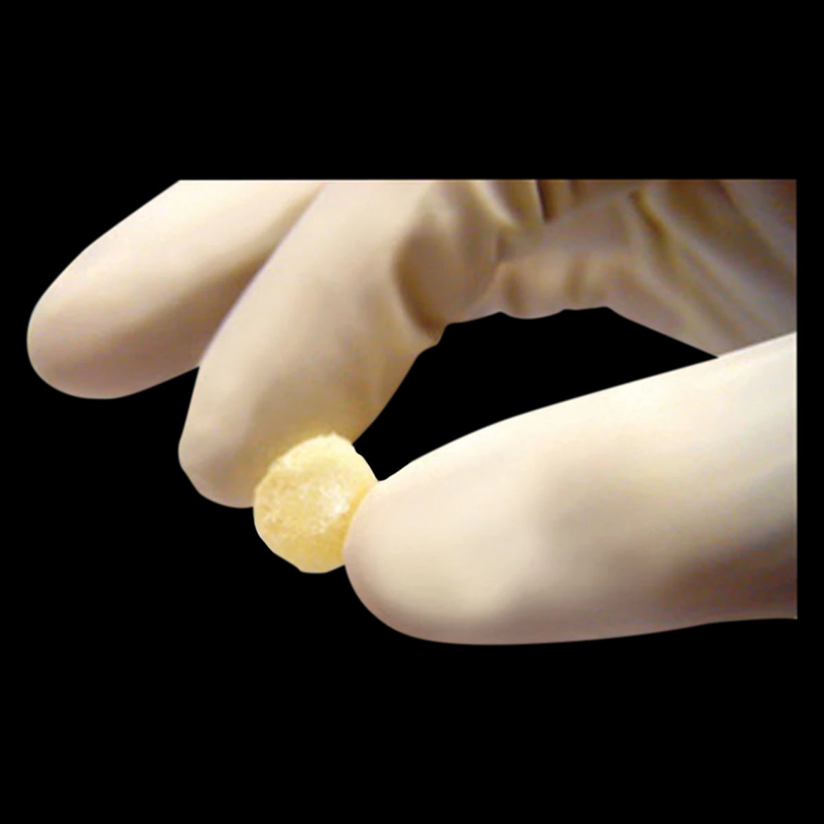 Grafton Bone Graft Putty, Demineralized Bone Fibers, 0.5 cc Syringe