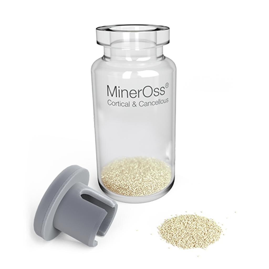 MinerOss Cortical & Cancellous Bone Graft Granules, Allograft, 1.0 cc