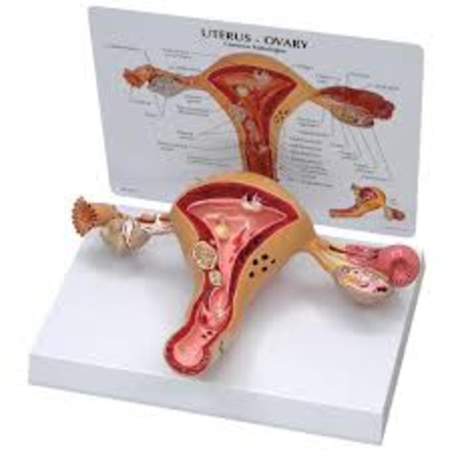 3B Scientific Uterus/Ovary Training Model, 8.75 x 6.25 x 2.5 in