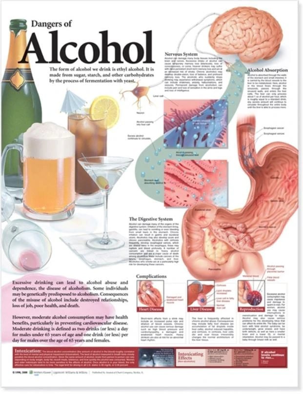 Dangers of Alcohol Educational Chart, 20" x 26", Flexible, Each