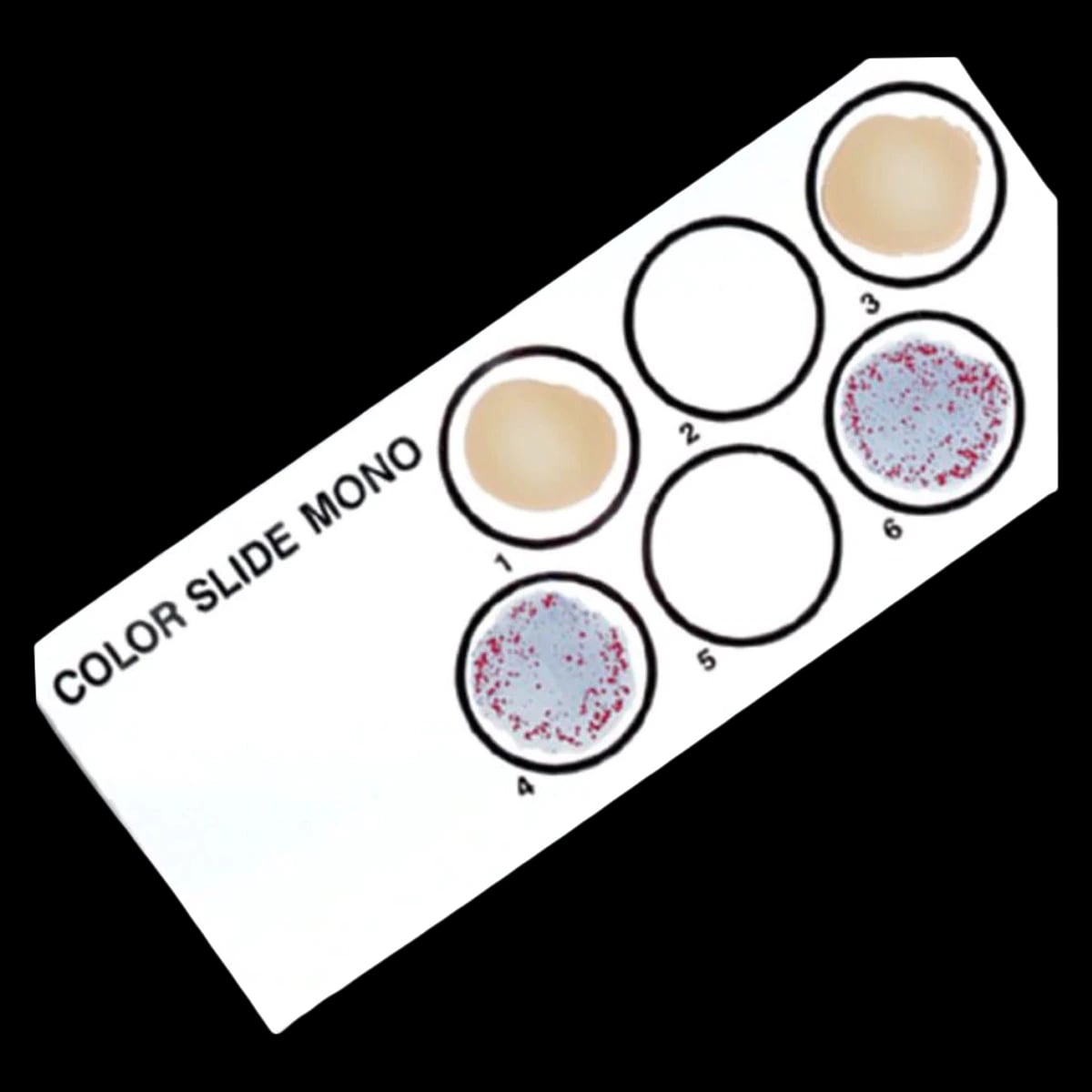 Remel Color Slide II Mononucleosis Test Kit, 50 Tests/Kit