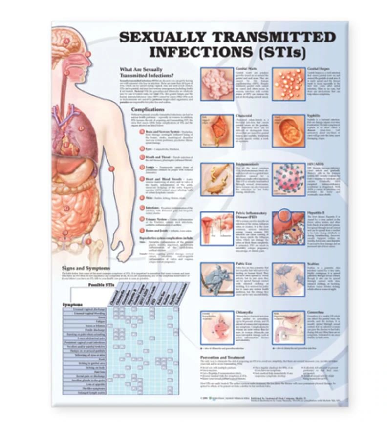 Sexually Transmitted Infections Educational Chart, 20" x 26", Flexible, Each