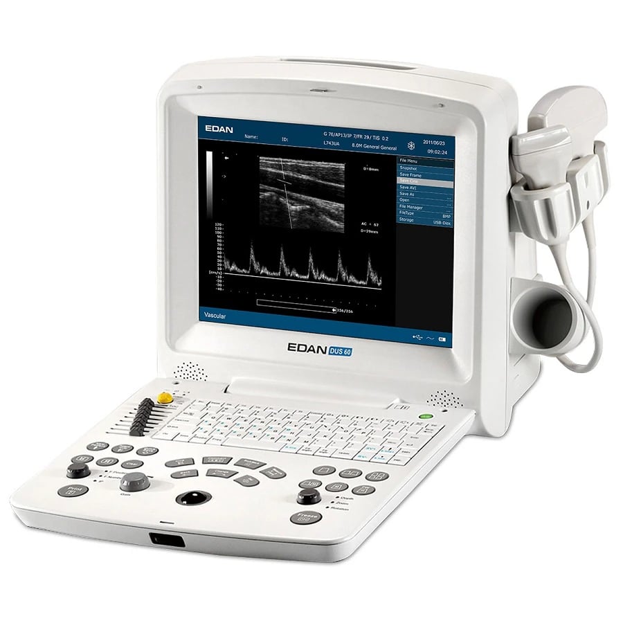 Edan DUS60 B/W Ultrasound System