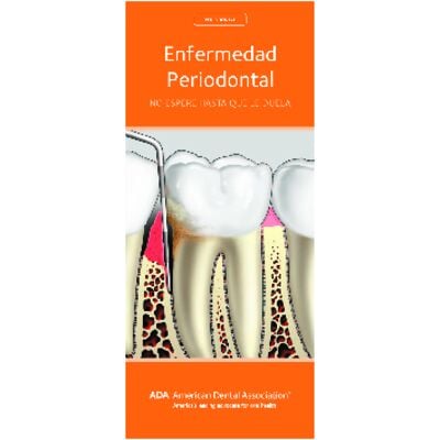ADA® Brochures, 12 Panel, 3-7/8" W x 9" H, 50/Pkg - Periodontal Disease – Spanish