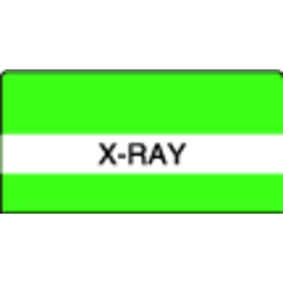 Patterson Office Supplies Index Tab, 1-1/2" W x 1-1/2" H, 102/Pkg - X-ray, Light Green Stripes