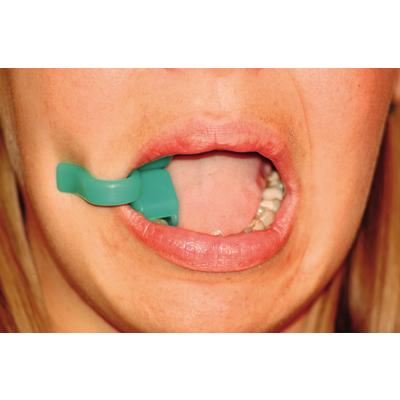 Open-Ex Silicone Bite Block, Autoclavable, 12/Pkg