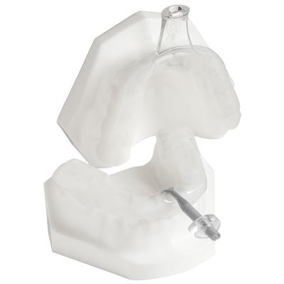 myTAP Precision-Fit Oral Appliance, Clear, Latex Free, Custom Fit, 1/Pkg