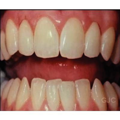 Dr. Christensen's Clinical Tips for Hygienists from Dentists DVD