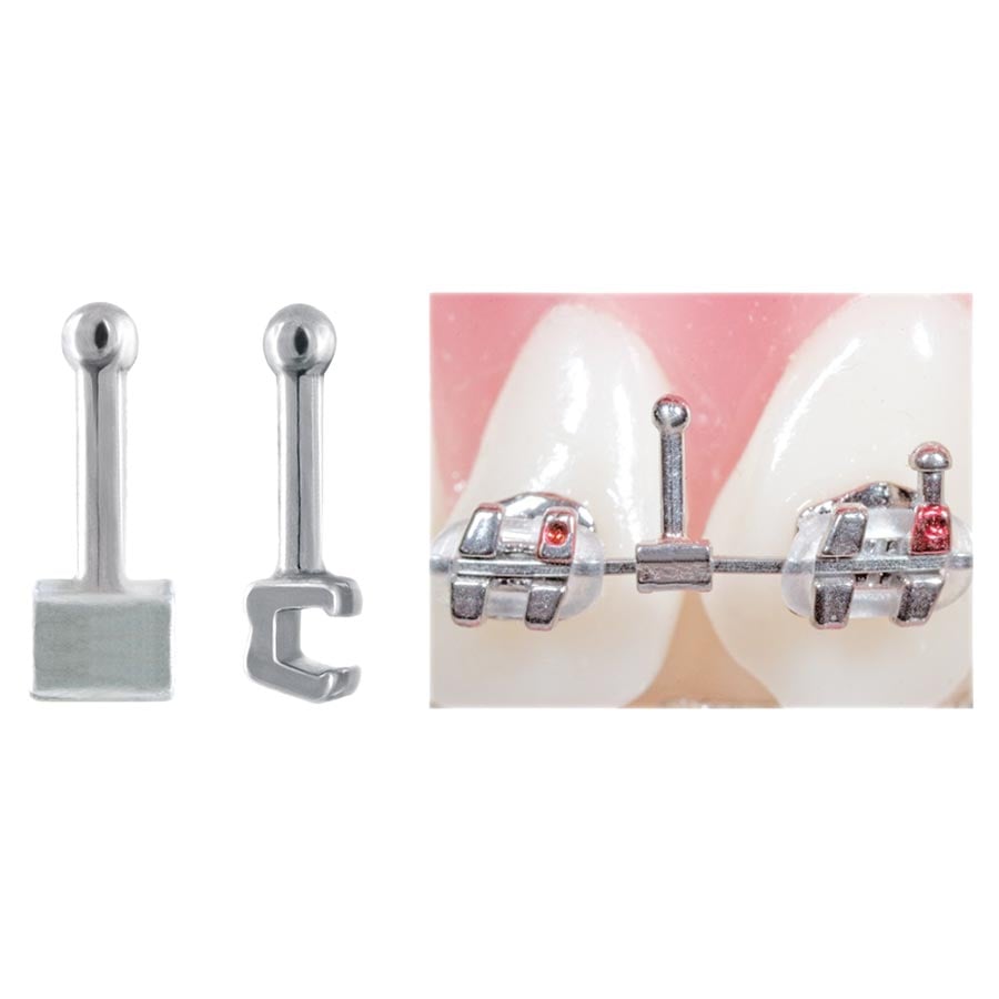 Crimpable Ball Hooks with Split Archwire Opening, 20/Pack, 20105