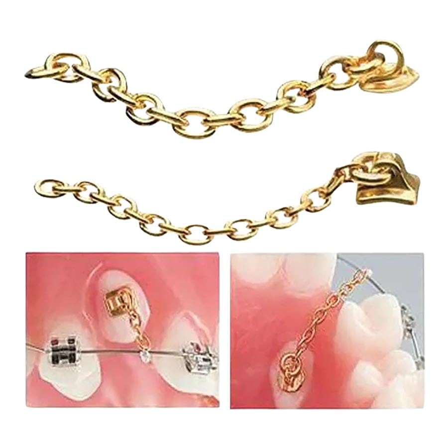 Fairfield Orthodontics Eruption Chain, Gold with Round Base, 5/Pkg, G19644