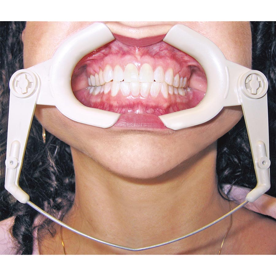 Ortho Cheek Retractor, Wire Type, 601-190