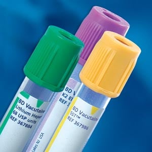 BD Vacutainer Plus Plastic Serum Blood Collection Tube, Red, 10 mL, 16 x 100 mm, 100/Box, 367820