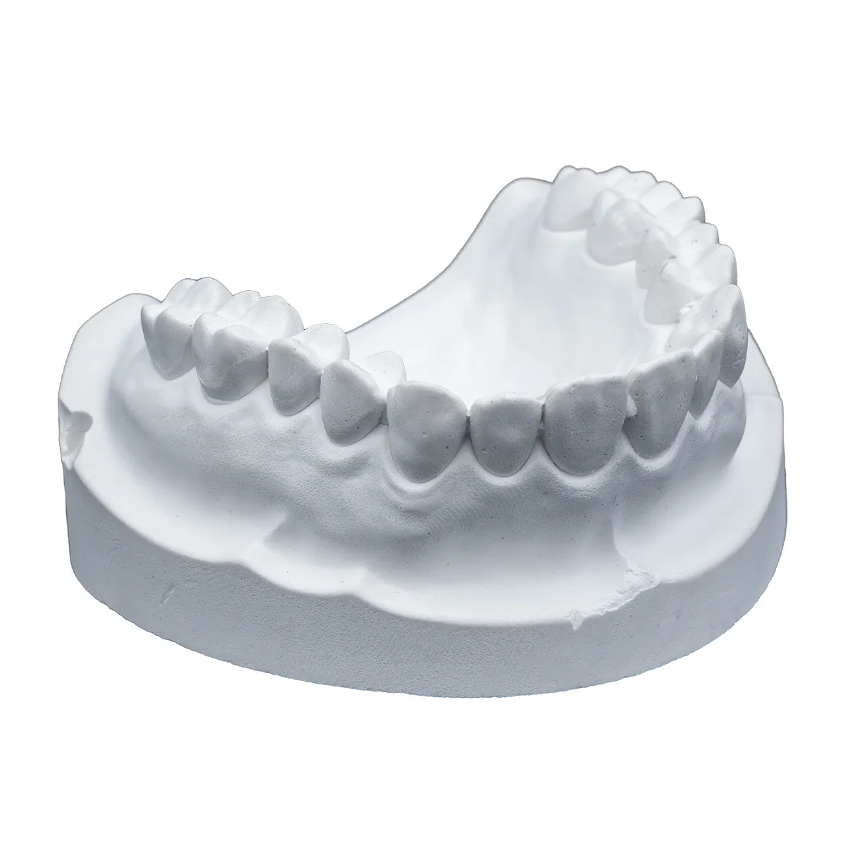 Whip Mix 33 lb / 15 kg White Plaster, 330090