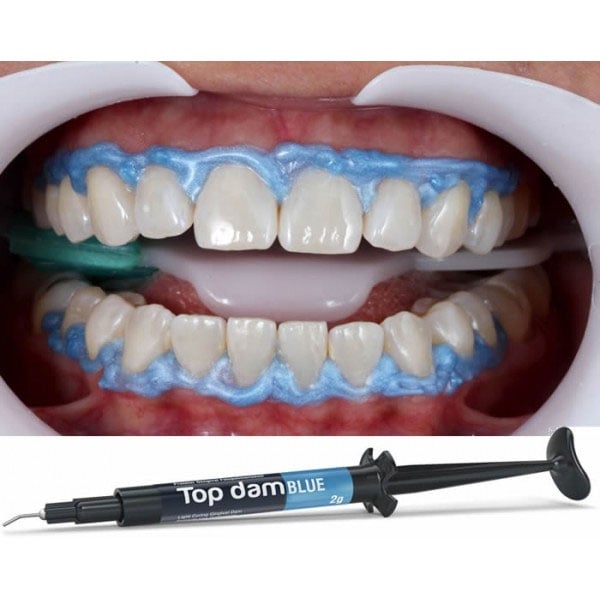 Top Dam Light-Curing Resin Gingival Dam, Blue, 2g Syringe with 3 Applicator Tips