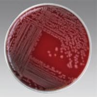 Remel Mueller-Hinton Agar with 5% Sheep Blood, 100mm Plates, 100/Package - MH Agar w/5% Sheep Blood - Image 1
