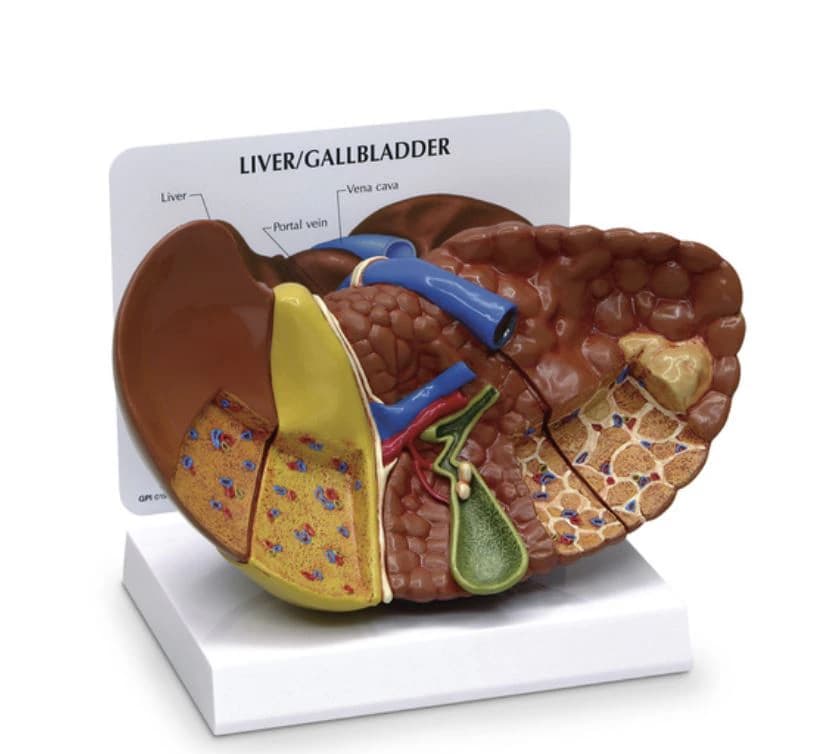 Nasco Healthcare Liver Anatomical Model with Pathologies, Full-Size, 8 x 4.5 x 5.5 inches - Model Liver w/Pathologies - Image 1