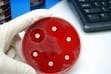 Lomefloxacin Antimicrobial Susceptibility Test Discs, 10 mcg, 250 Discs/Package - Lomefloxacin 10mcg - Image 1