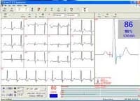Norav Medical ECG Interpretation Software (Per Each) - Software Means Interpretation - Image 1