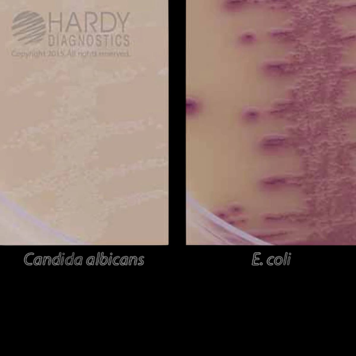 Hardy Diagnostics HurBi BiPlate Culture Urine Medium, 18 mL, 15x100mm, 10/Package - HurBi BiPlate Urine Med 18mL - Image 1