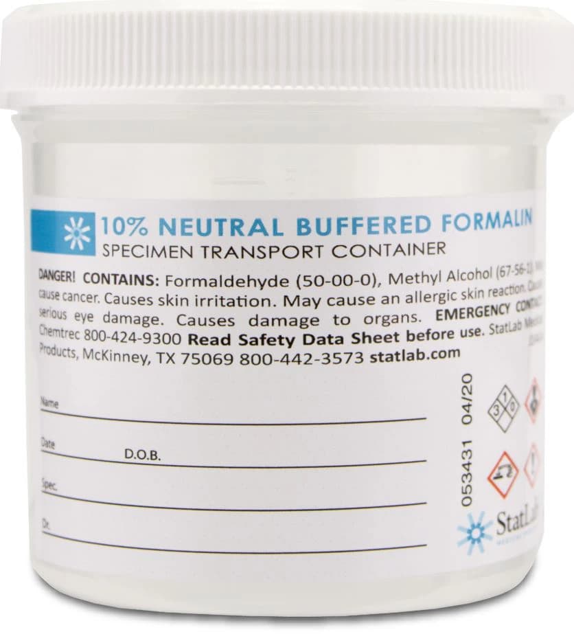 Statlab Medical Products Prefilled Container with Neutral Buffered Formalin, 180 mL, 50/Case - Formalin Container Prefill - Image 1