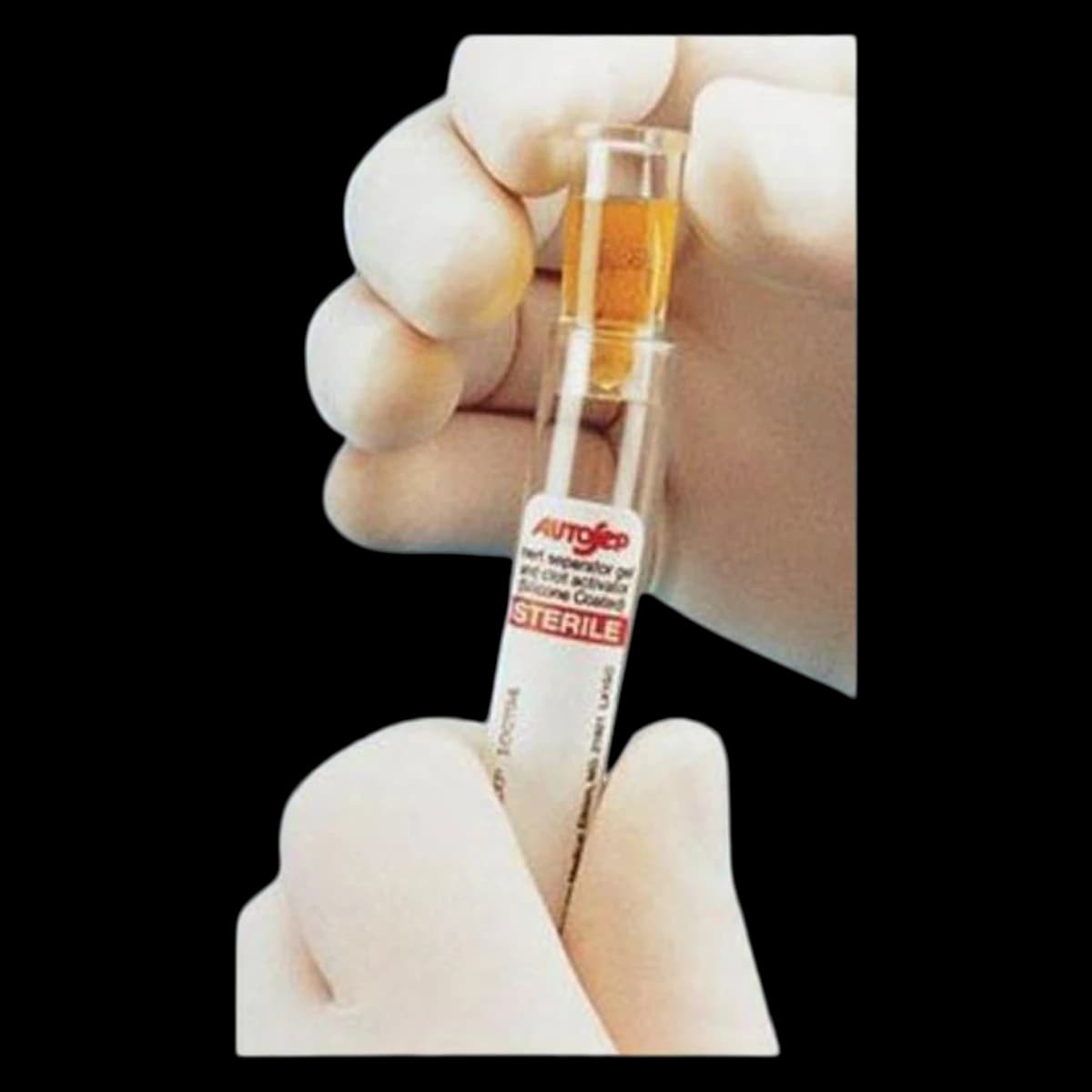 Beckman Coulter Ezee-Nest Sample Cup, 2mL, 1000/Case - Cup Sample 2mL Ezee-Nest - Image 1