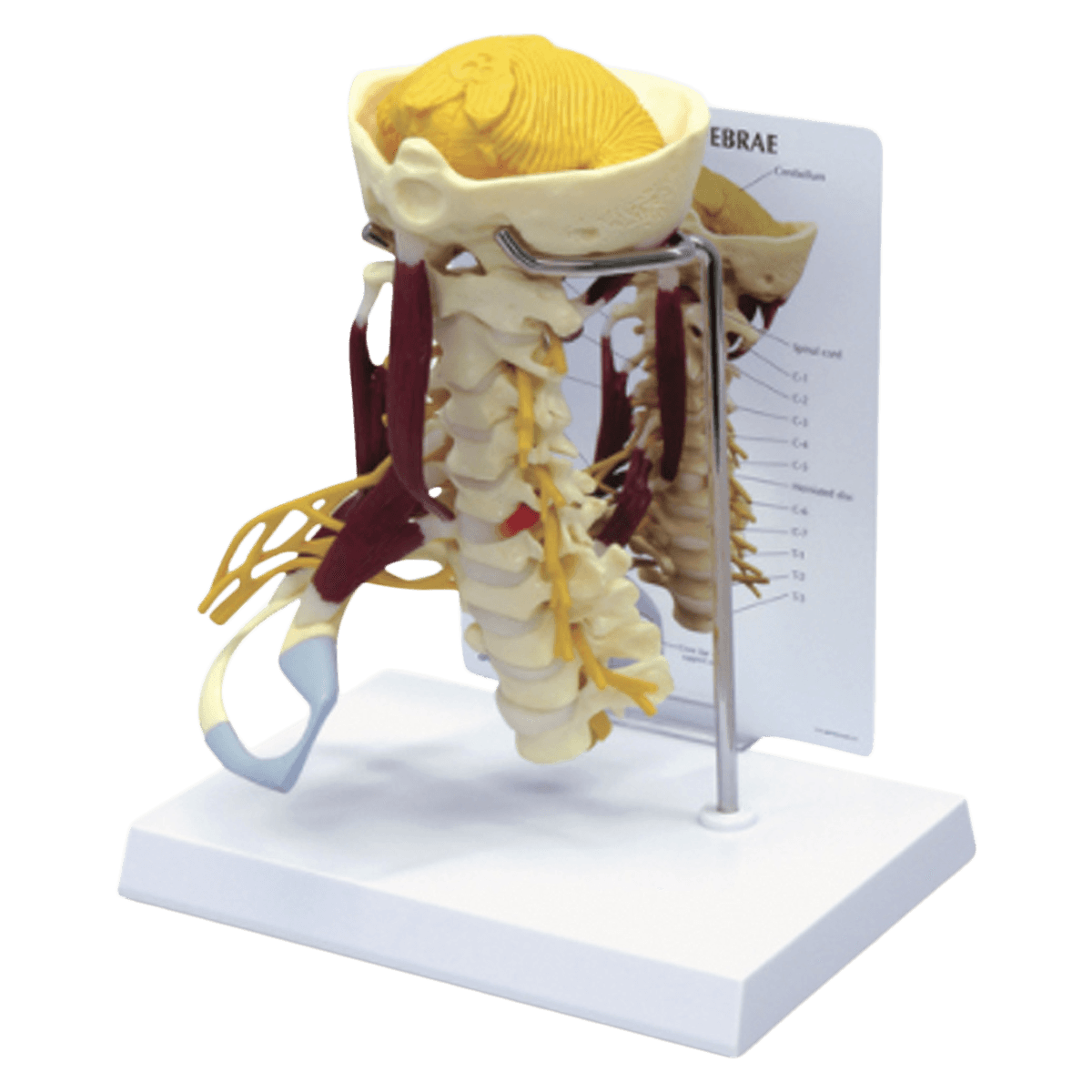 Cervical Spinal Column Anatomical Model with Muscles and Nerves, Life-Size, Multicolor, Base Mounted, 5-1/2x6-1/2x10" - Model Cervical w/ Musc/Nrv - Image 1