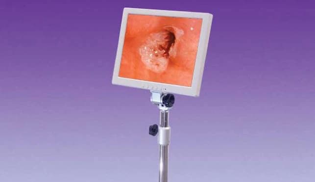 Gynex Corporation Monitor Only for Desktop/Galileo VC Colposcope (No Stand) - Monitor Only f/Desktop No Stnd - Image 1