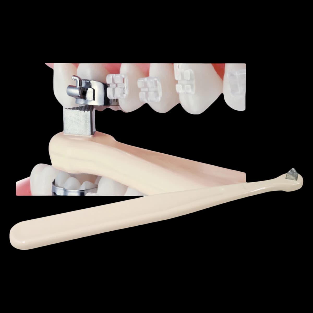 Ortho Technology High Heat Bite Stick, Reverse Triangle Tip, Single End, OT-600-199 - High Heat Bite Stick - Image 1
