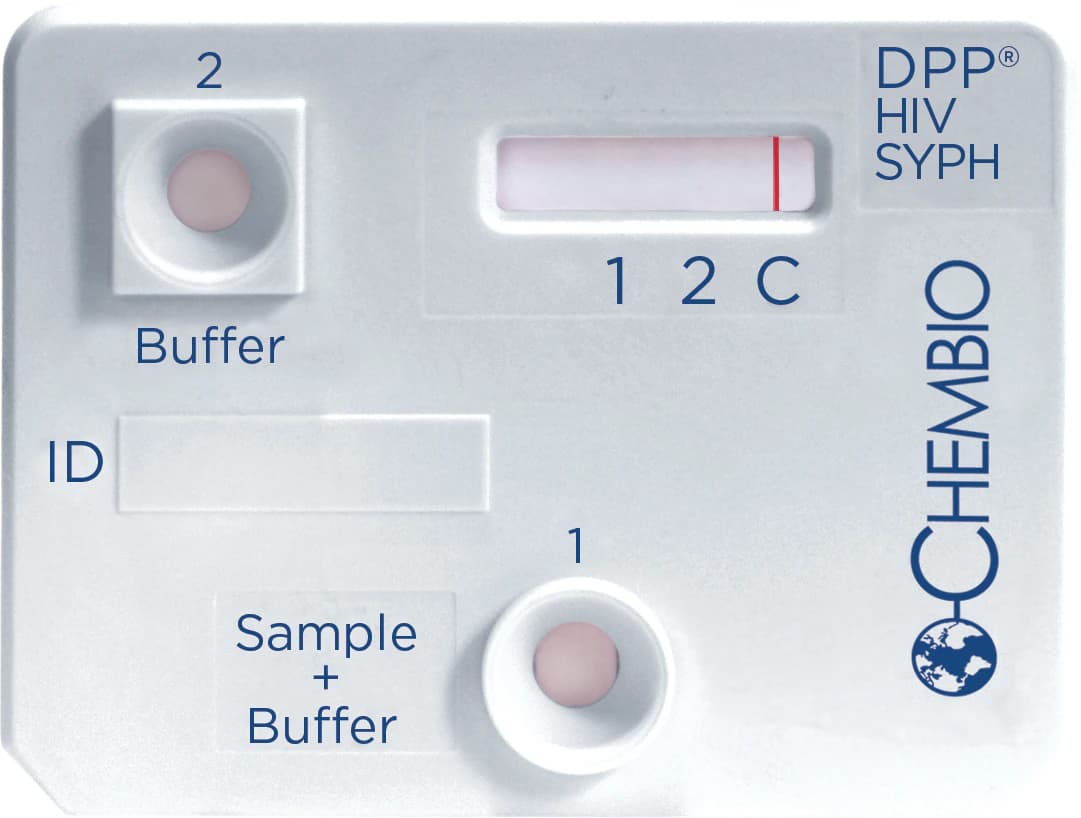 DPP HIV-Syphilis Rapid Test, CLIA Waived, For Micro Reader, 20 Tests/Kit - DPP HIV-Syphilis Assay - Image 1