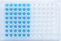 Gold Standard Diagnostics Anti-TG IgG ELISA Test Kit, 96 Tests - Anti-TG IgG - Image 1