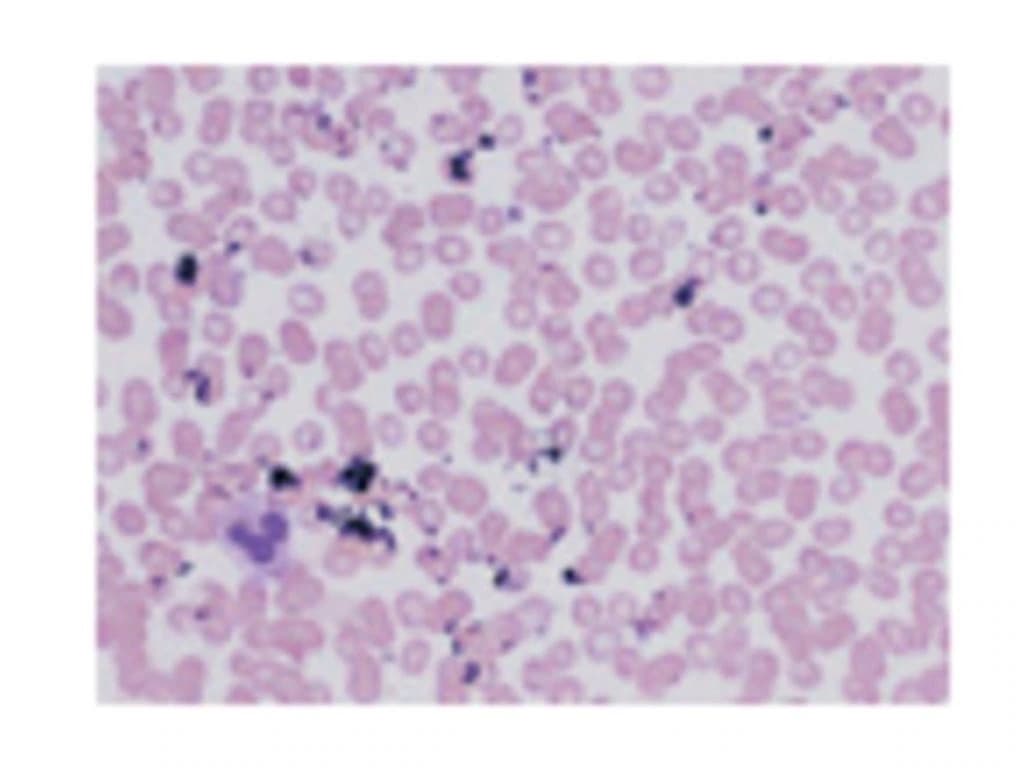 Richard-Allan Scientific Giemsa Stain, 32 oz Bottle - Stain Giemsa - Image 1