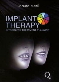 Implant Therapy: Integrated Treatment Planning Volume 1 by Mauro Merli, 792 pp, ISBN 978-88-7492-170-6 - Implant Therapy: Integrated Treatment Planning Volume 1 / Merli Mauro - Image 1