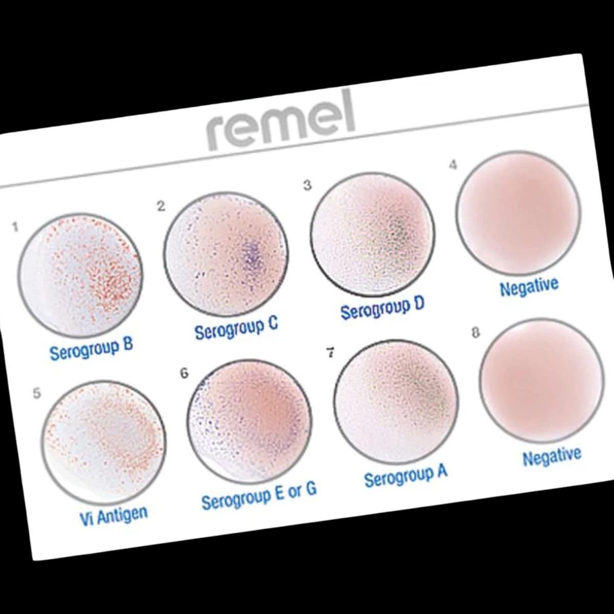 Wellcolex Colour Salmonella Rapid Latex Agglutination Test Kit, 50 Tests/Kit - Wellcolex Colour Salmonella - Image 1