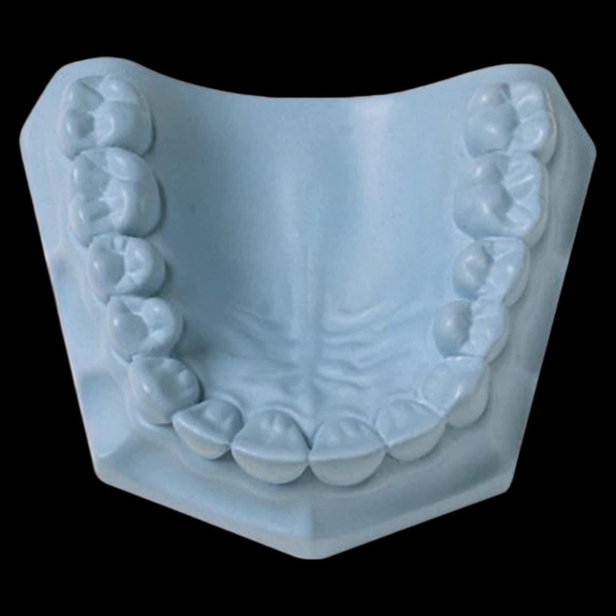 Whip Mix Quickstone Laboratory Stone, ISO Type 3, Blue, 33 lb Carton (330061) - Quickstone Laboratory Stone 33 lb. Carton - Image 1