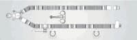 SunMed Ventilation Circuit, 10/Case - Vent Circuit - Image 1
