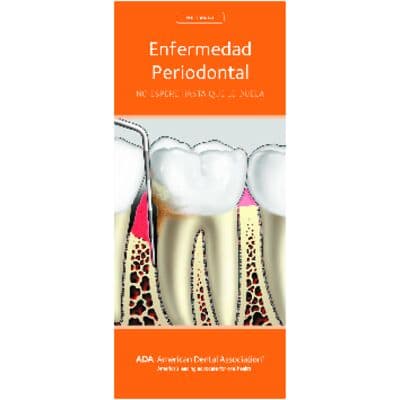 ADA® Brochures, 12 Panel, 3-7/8" W x 9" H, 50/Pkg - Periodontal Disease – Spanish - ADA® Brochures, 12 Panel, 3-7/8" W x 9" H, 50/Pkg - Periodontal Disease – Spanish - Image 1