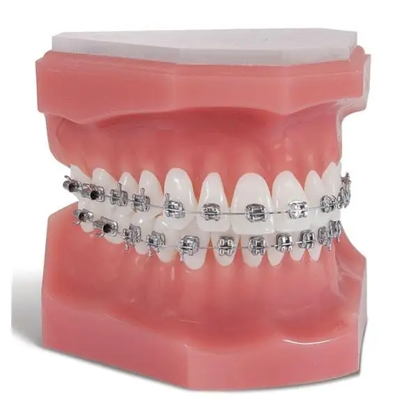 Ortho Technology .018" Roth Upper Left 4/5 Hook 7T 0A 2DO Brackets, 10/Pkg - .018 R UL 4/5 HK 7T 0A 2DO, 10/Pkg. - Image 1