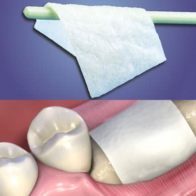 MatrixFlex Regenerative Collagen Dental Membrane, 15mm x 20mm, 1/Box - MatrixFlex regenerative collagen dental membrane 15mm x 20mm, 1/Box. Strong - Image 1