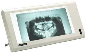 Dux Dental Luminator Slim-Line X-Ray Viewer, Ivory (Neutral), All Plastic, Single Viewer - Luminator Slim-Line X-Ray Viewer. Ivory (Neutral) All Plastic Construction - Image 1